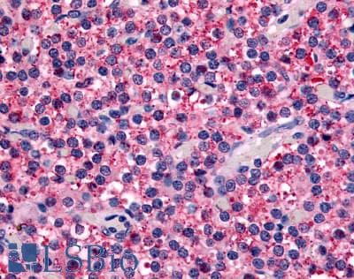 IHC-plus™ CASR/Calcium Sensing Receptor Antibody (N-Terminus)