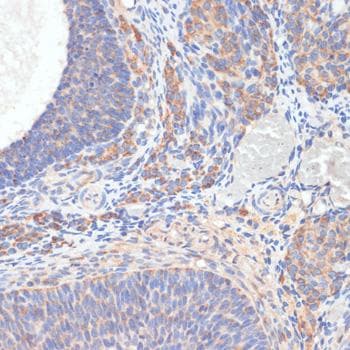 Polyclonal Rabbit anti-Human TES / Testin Antibody (IHC)