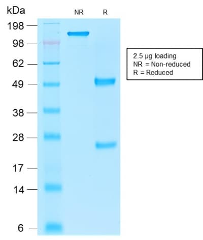 EPCAM Antibody (aa 280-350, clone rEGP40/1110, Azide-free, Carrier-free)