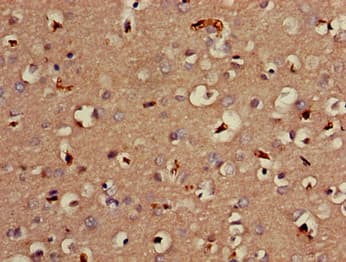 Polyclonal Rabbit anti-Human MTNR1B / MT2 Antibody (IHC, IF)