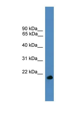 Polyclonal Rabbit anti-Human UBL4A Antibody (aa81-130, WB)