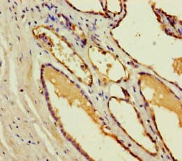 Polyclonal Rabbit anti-Human CST11 Antibody