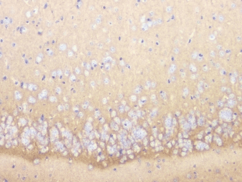 Polyclonal Rabbit anti-Human CD47 Antibody (IHC, IF, WB)