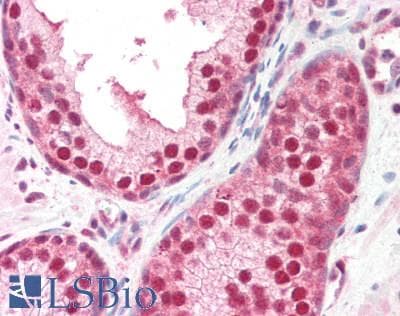 IHC-plus™ Polyclonal Goat anti-Human GPS1 / CSN1 Antibody (aa516-527, IHC, WB)