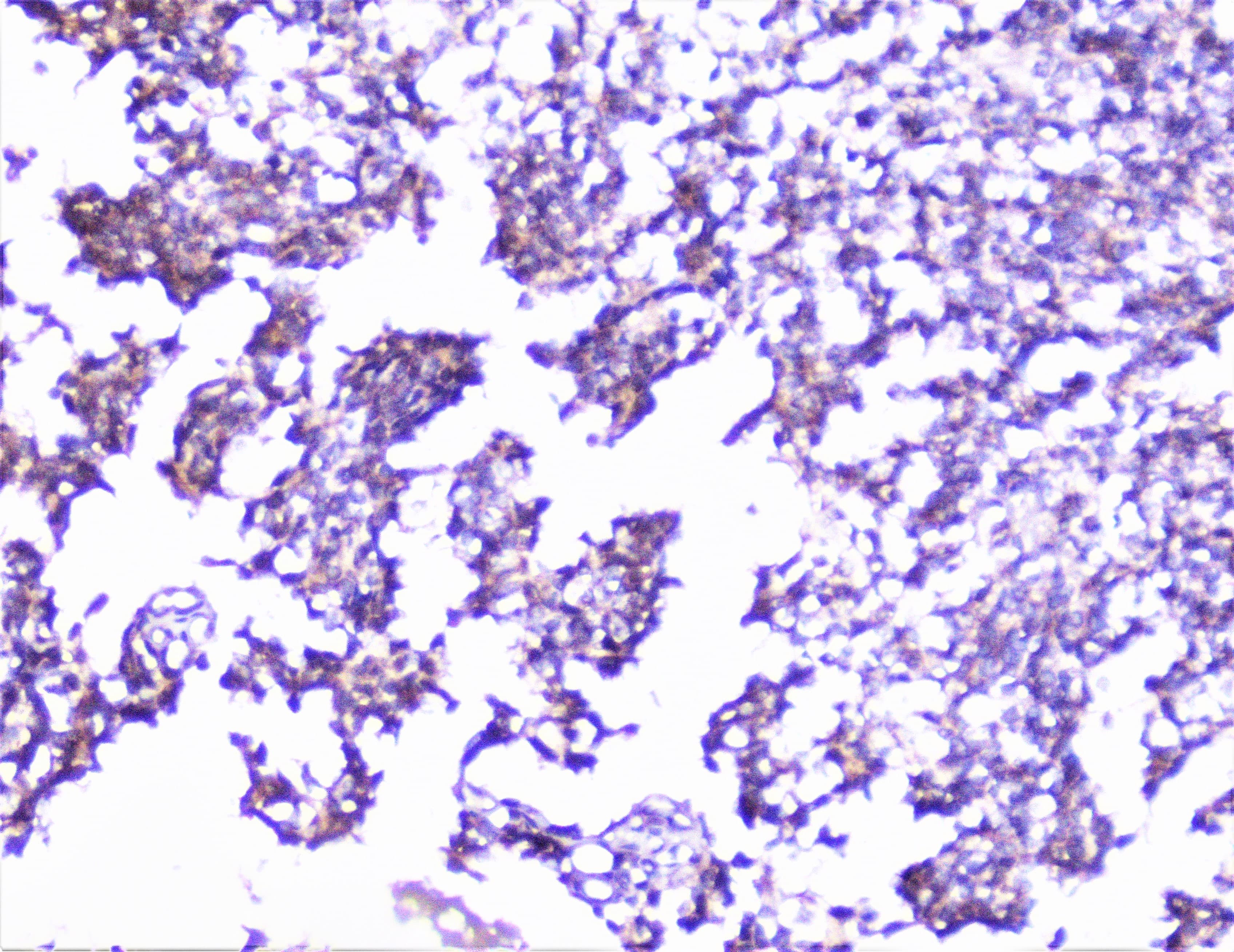 CTTN / Cortactin Antibody