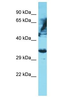 OR6K2 Antibody (aa274-323)