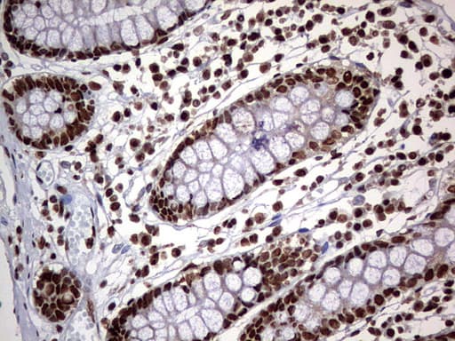 HNRPM / HNRNPM Antibody (aa1-261, clone OTI1E12)