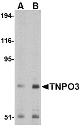 Transportin-SR / TNPO3 Antibody