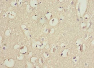 Polyclonal Rabbit anti-Human PIK3R3 / p85 Gamma Antibody (IHC, WB)