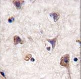 Polyclonal Rabbit anti-Human MAP1LC3A / LC3A Antibody (aa1-30, IHC, IF, WB)