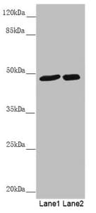 Polyclonal Rabbit anti-Human PSTPIP1 Antibody (IHC, WB)