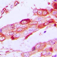 Polyclonal Rabbit anti-Human SSBP1 / mtSSB Antibody (C-Terminus, IHC, IF, WB)