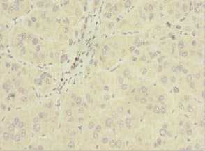 Polyclonal Rabbit anti-Human INPP5J / PIB5PA Antibody (IHC)