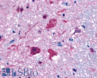 PathPlus™ Polyclonal Rabbit anti-Human GPR35 Antibody (Extracellular Domain, IHC)