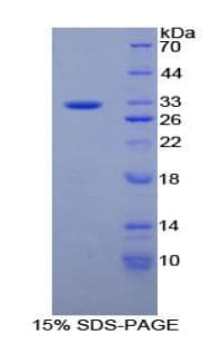 Human HPTPB / PTPRB Protein (Recombinant His-T7)
