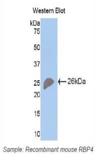 RBP4 Antibody (aa63-245, PE)
