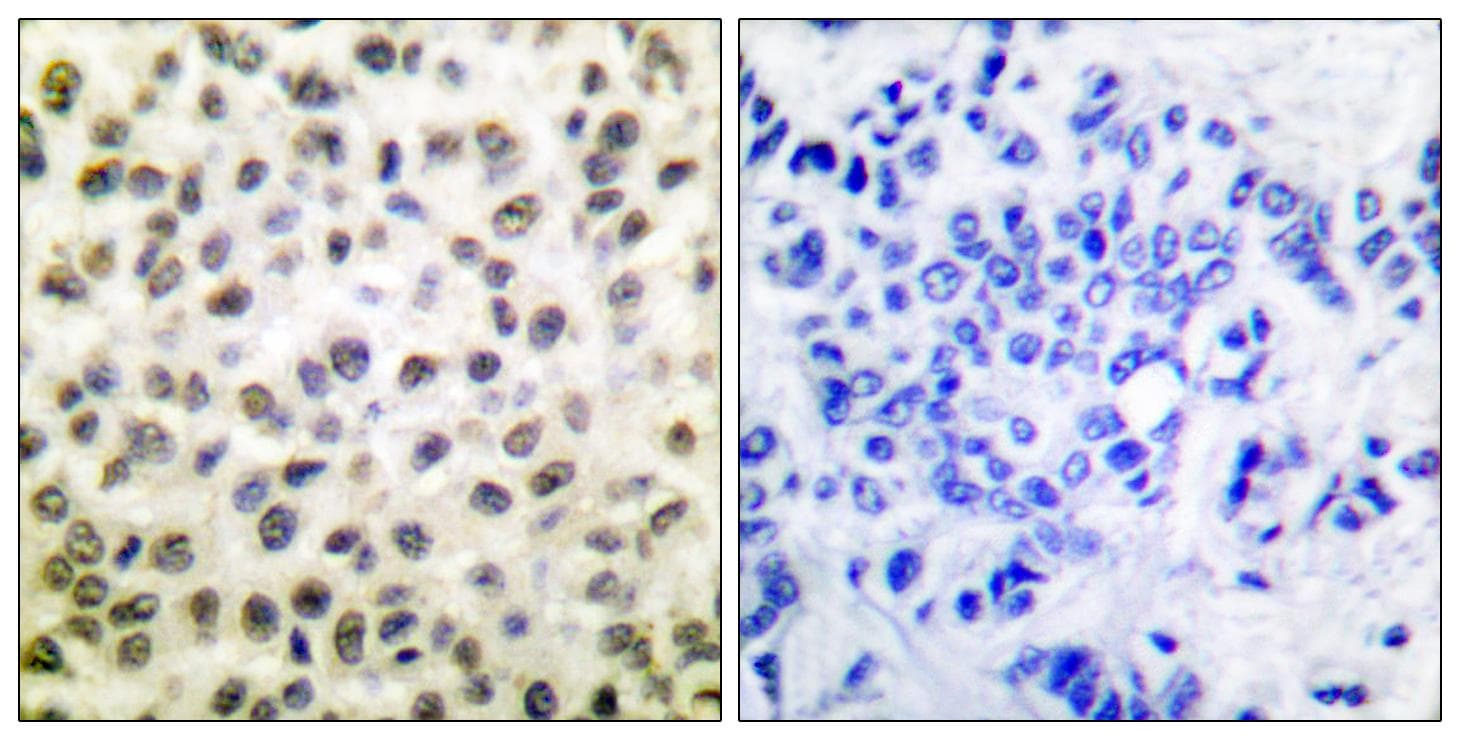 STAT5B Antibody (p731)