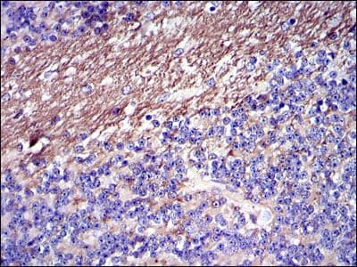 FGG / Fibrinogen Gamma Antibody (clone 4H9)