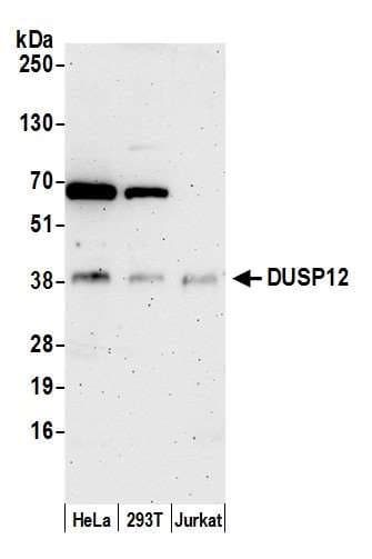 DUSP12 Antibody (aa1-50)