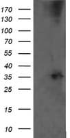 CD1C Antibody (clone OTI2B3)