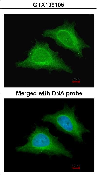 PRKAG2 / AMPK Gamma 2 Antibody (aa192-569)