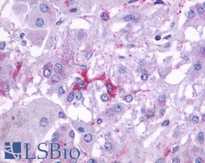 PathPlus™ ADRB3 Antibody (C-Terminus)