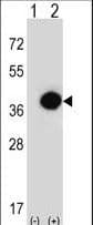 RD / PHYH Antibody (aa59-87)