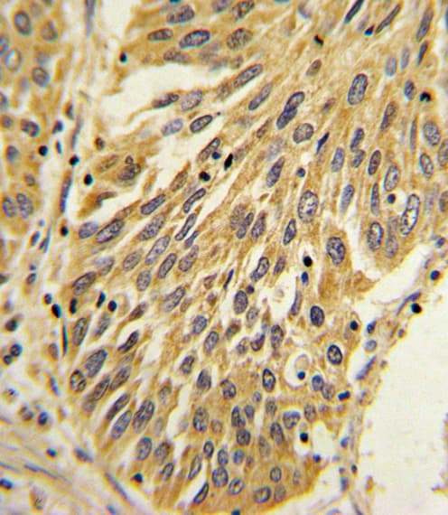 IL-1B / IL-1 Beta Antibody (aa148-174)