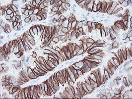 FXYD3 Antibody (clone OTI1F12)