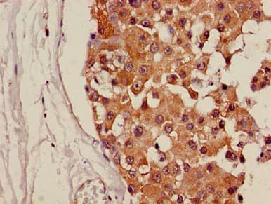 Polyclonal Rabbit anti-Human CDH18 / Ey-Cadherin Antibody (IHC, IF, WB)