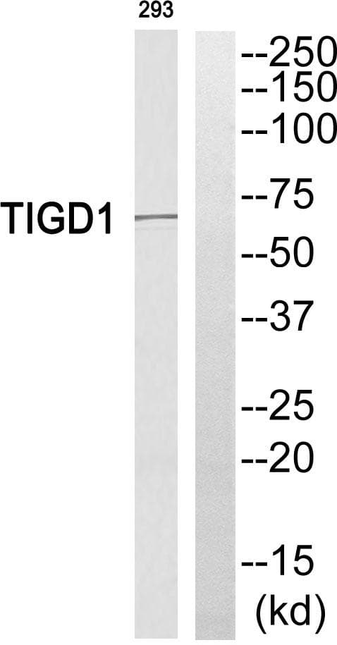 EEYORE / TIGD1 Antibody