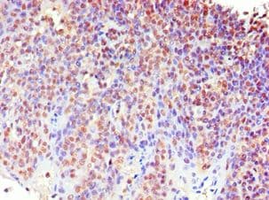 MECP2 Antibody (aa1-280)