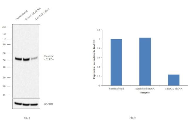 CAMK4 / CaMK IV Antibody (Amino Acid: 35-292, clone 8C5B8)