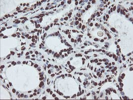 NONO / P54NRB Antibody (clone OTI2C9)