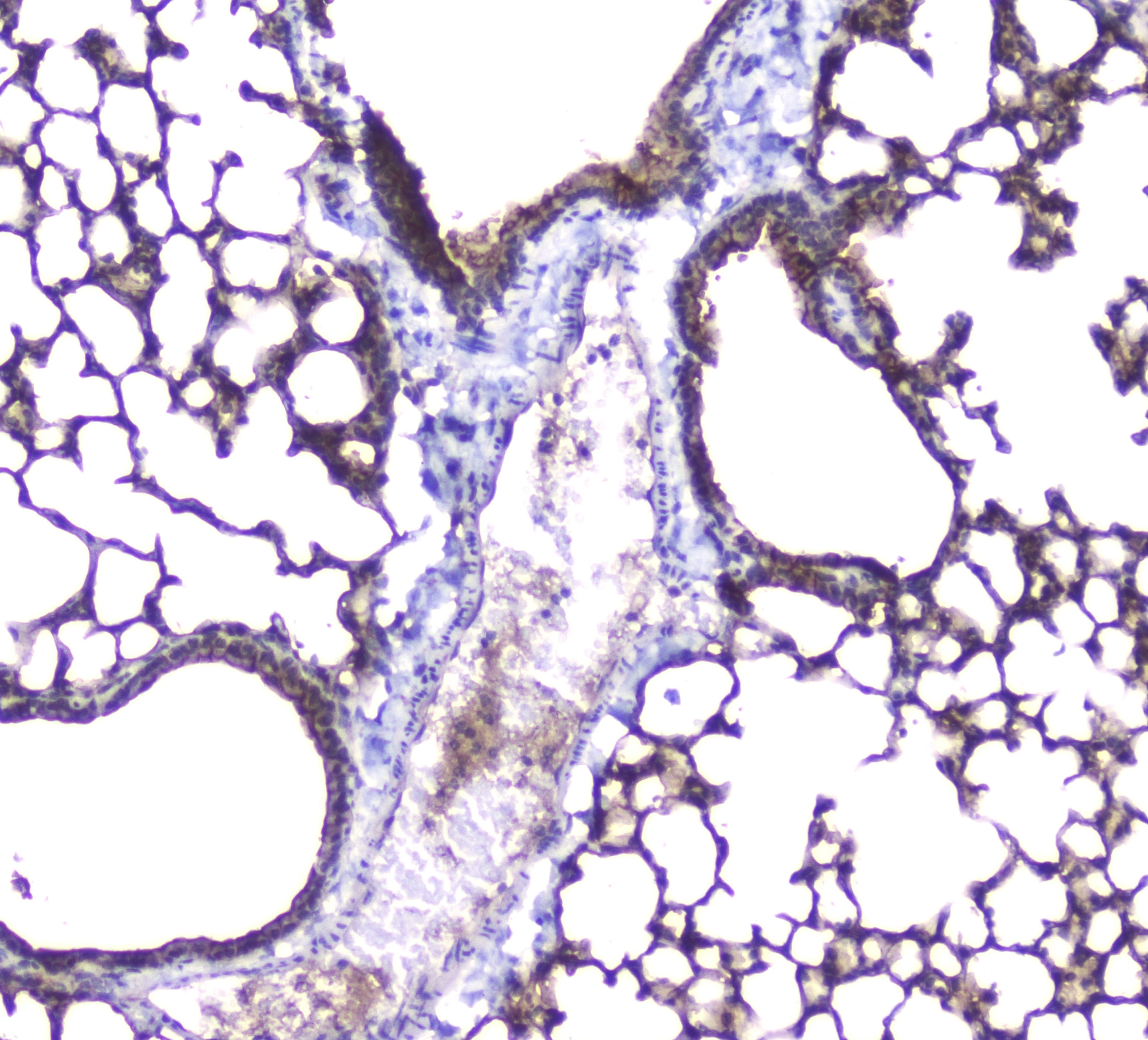 Polyclonal Rabbit anti-Human AQP5 / Aquaporin 5 Antibody (IHC, WB)