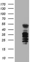 SERPINB2 / PAI-2 Antibody (clone OTI1E3, Carrier-free)