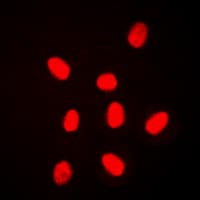 MAPK6 / ERK3 Antibody (Internal)