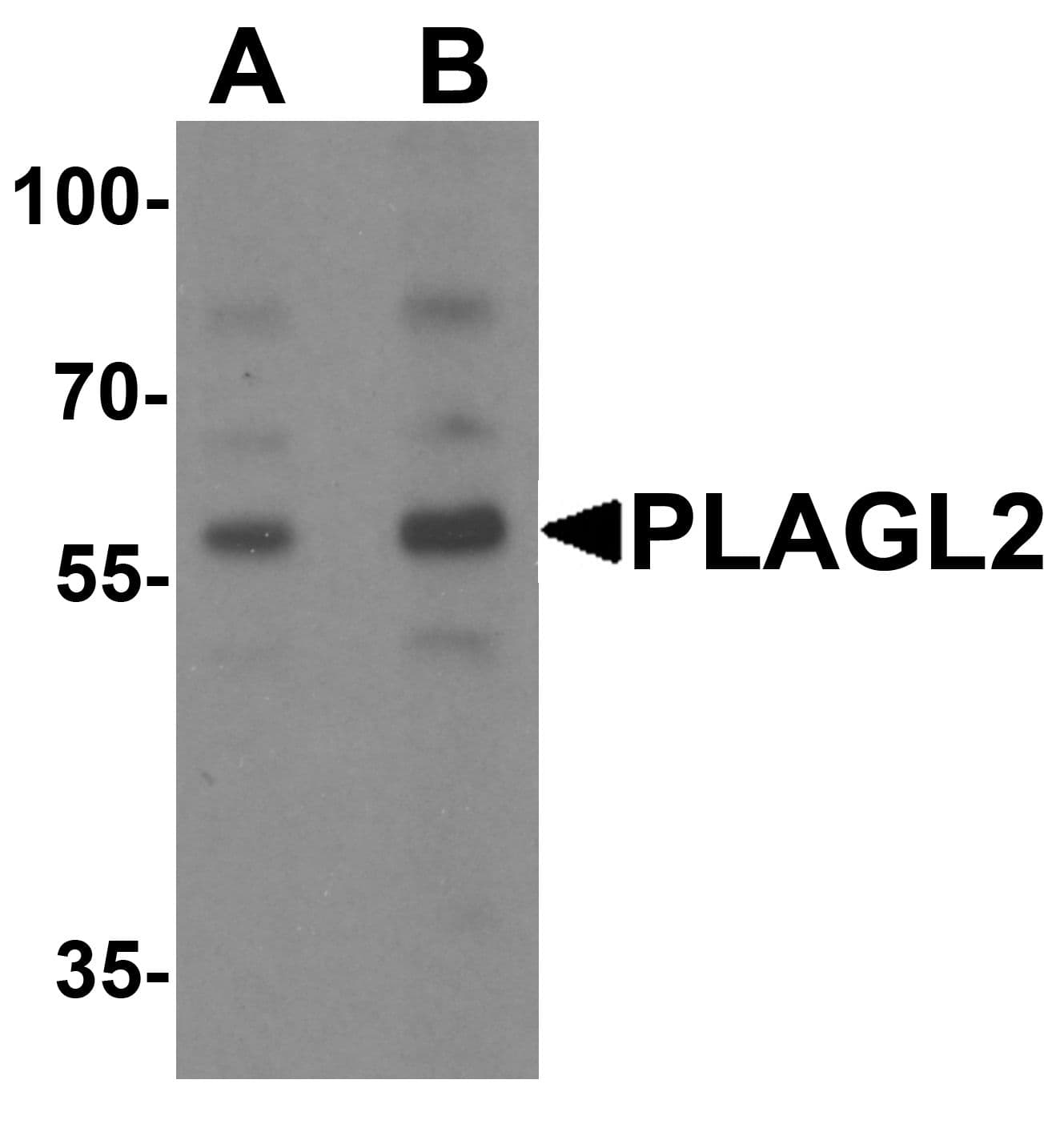 Polyclonal Rabbit anti-Human PLAGL2 Antibody (IHC, IF, WB)
