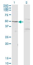 IHC-plus™ Monoclonal Mouse anti-Human MAPK8 / JNK1 Antibody (clone 3B12, IHC, WB)