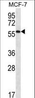 SAAL1 Antibody (aa357-385)