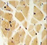 Polyclonal Rabbit anti-Human GCLM Antibody (aa246-274, IHC, IF, WB)