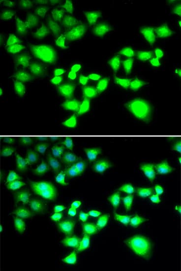 Polyclonal Rabbit anti-Human RAD1 Antibody (IHC, IF, WB)