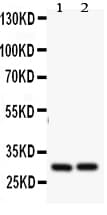 Polyclonal Rabbit anti-Human BCL2A1 Antibody (aa1-16, WB)