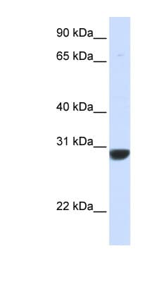 PNPO Antibody (aa36-85)