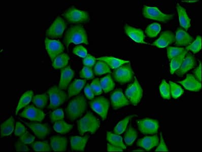 HSD17 / HSD17B1 Antibody