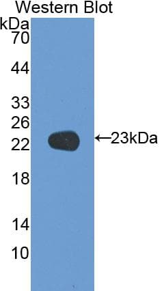F5 / Factor Va Antibody (aa1941-2095)