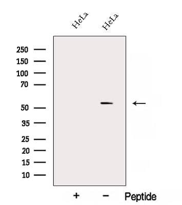 ALG1 Antibody