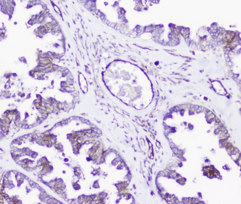 INPPL1 / SHIP2 Antibody