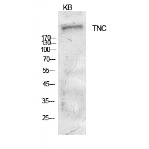 Polyclonal Rabbit anti-Human TNC / Tenascin C Antibody (C-terminal, IHC, WB)