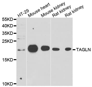 IHC-plus™ Polyclonal Rabbit anti-Human TAGLN / Transgelin / SM22 Antibody (IHC, IF, WB)